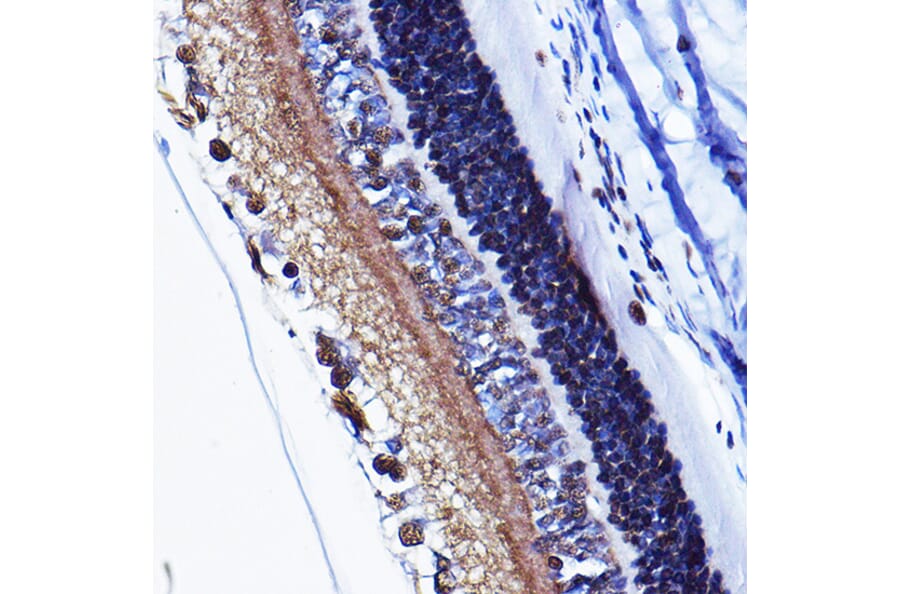Immunohistochemistry - Anti-Cyclin D1 (phospho Thr286) Antibody (A305286) - Antibodies.com