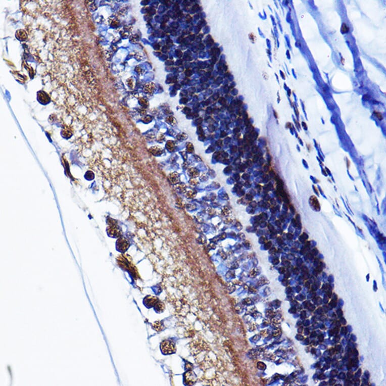 Immunohistochemistry - Anti-Cyclin D1 (phospho Thr286) Antibody (A305286) - Antibodies.com