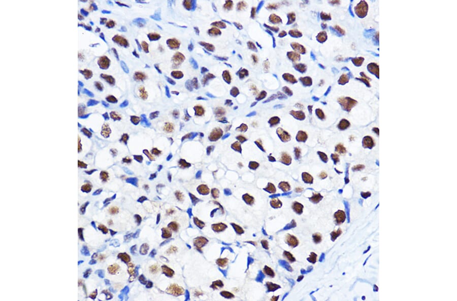 Immunohistochemistry - Anti-Cyclin D1 (phospho Thr286) Antibody (A305286) - Antibodies.com