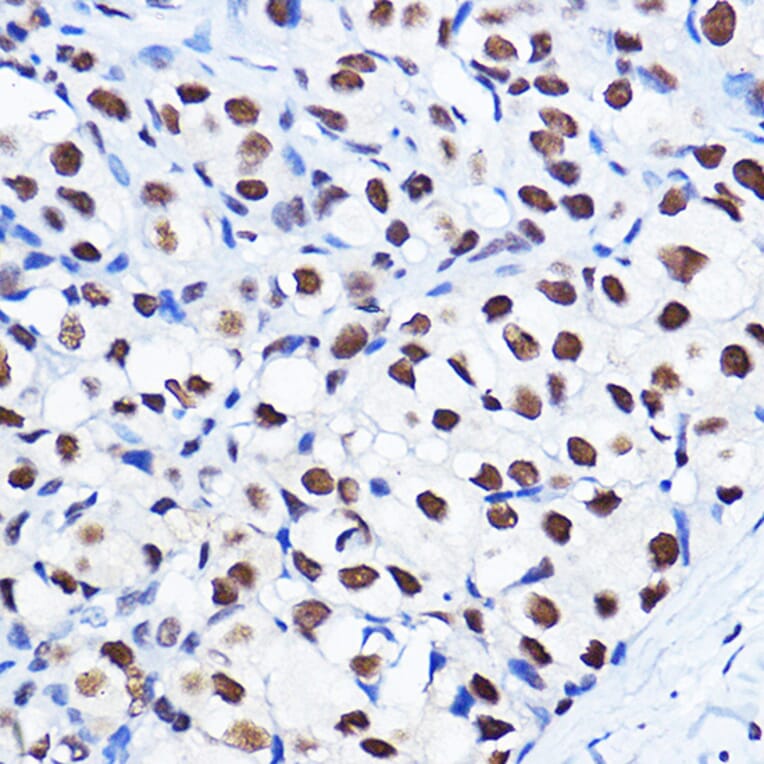 Immunohistochemistry - Anti-Cyclin D1 (phospho Thr286) Antibody (A305286) - Antibodies.com