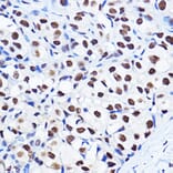 Immunohistochemistry - Anti-Cyclin D1 (phospho Thr286) Antibody (A305286) - Antibodies.com