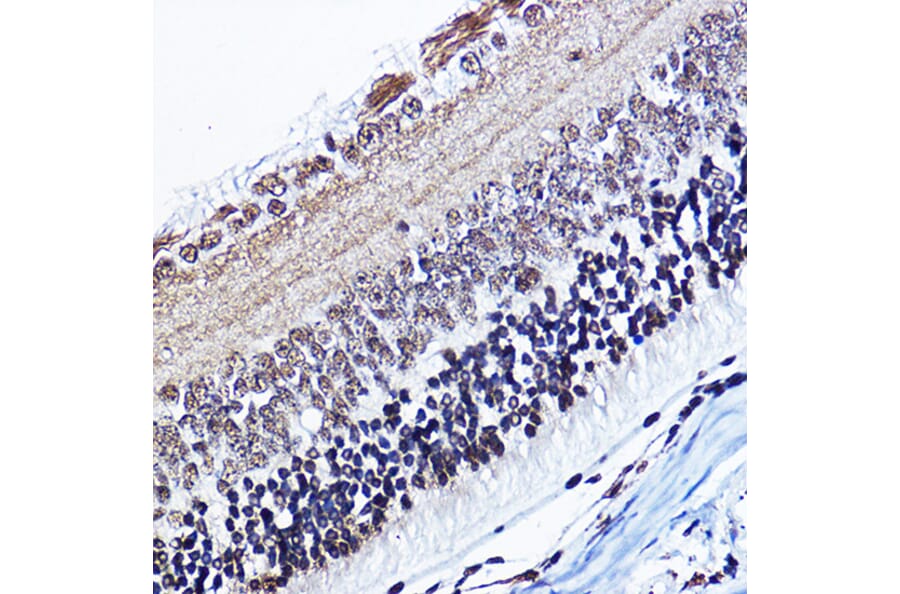 Immunohistochemistry - Anti-Cyclin D1 (phospho Thr286) Antibody (A305286) - Antibodies.com