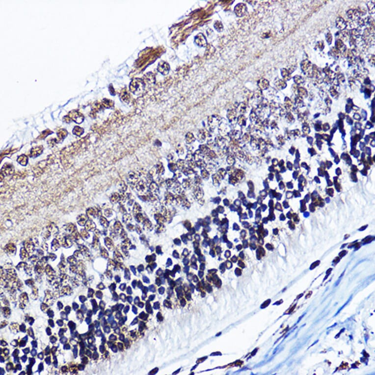 Immunohistochemistry - Anti-Cyclin D1 (phospho Thr286) Antibody (A305286) - Antibodies.com