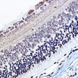 Immunohistochemistry - Anti-Cyclin D1 (phospho Thr286) Antibody (A305286) - Antibodies.com