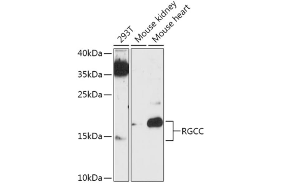 Western Blot - Anti-RGC-32 Antibody (A305287) - Antibodies.com