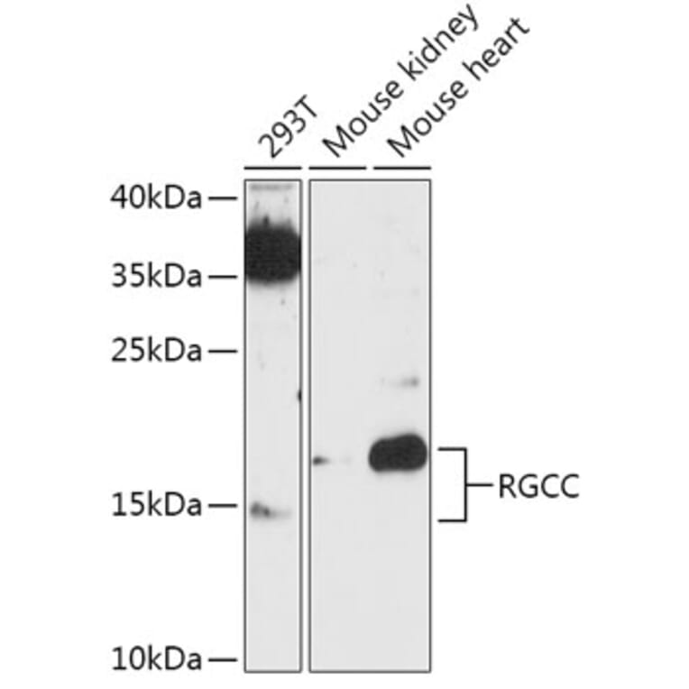 Western Blot - Anti-RGC-32 Antibody (A305287) - Antibodies.com
