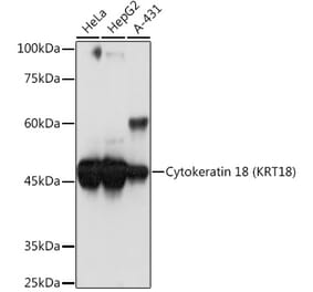 Western Blot - Anti-Cytokeratin 18 Antibody [ARC2303] (A305288) - Antibodies.com