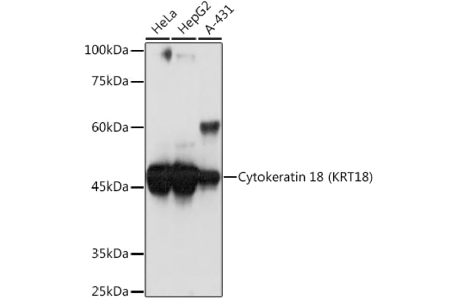 Western Blot - Anti-Cytokeratin 18 Antibody [ARC2303] (A305288) - Antibodies.com