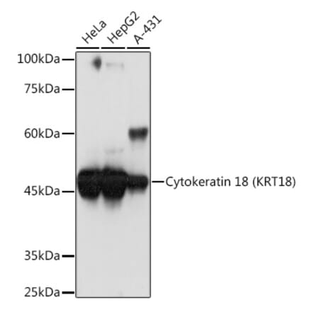 Western Blot - Anti-Cytokeratin 18 Antibody [ARC2303] (A305288) - Antibodies.com
