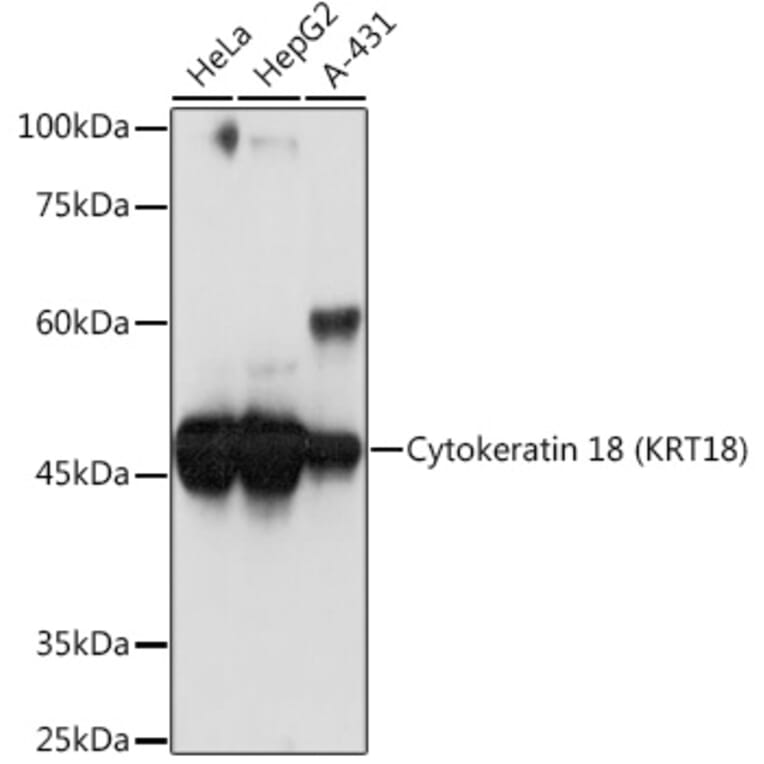 Western Blot - Anti-Cytokeratin 18 Antibody [ARC2303] (A305288) - Antibodies.com