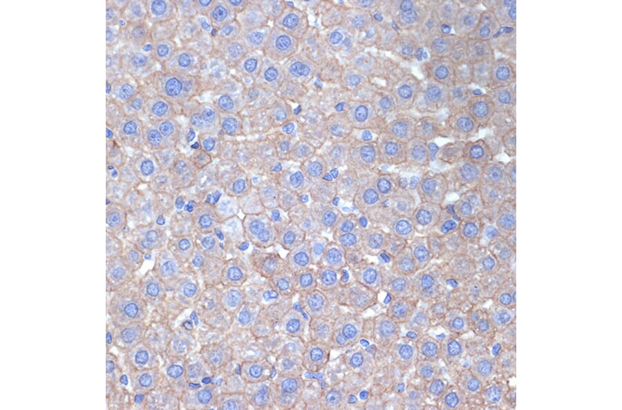 Immunohistochemistry - Anti-Cytokeratin 18 Antibody [ARC2303] (A305288) - Antibodies.com