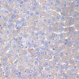 Immunohistochemistry - Anti-Cytokeratin 18 Antibody [ARC2303] (A305288) - Antibodies.com