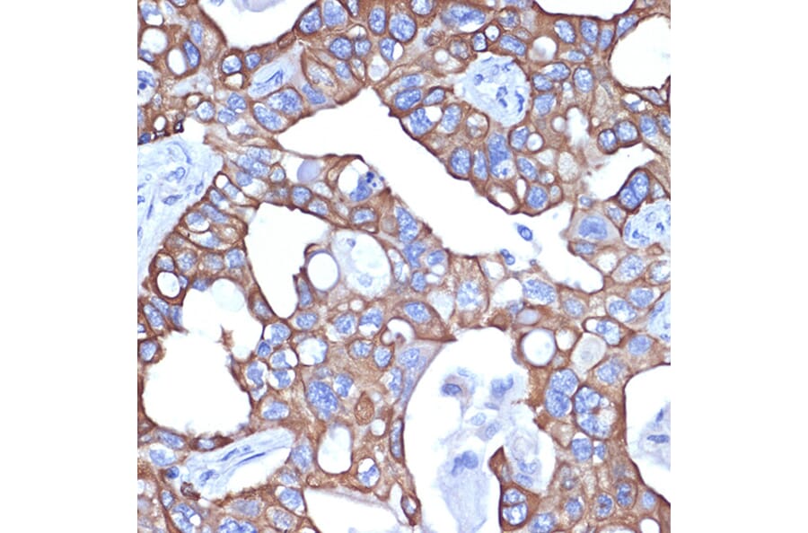 Immunohistochemistry - Anti-Cytokeratin 18 Antibody [ARC2303] (A305288) - Antibodies.com
