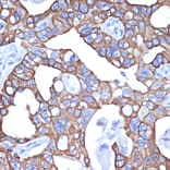 Immunohistochemistry - Anti-Cytokeratin 18 Antibody [ARC2303] (A305288) - Antibodies.com