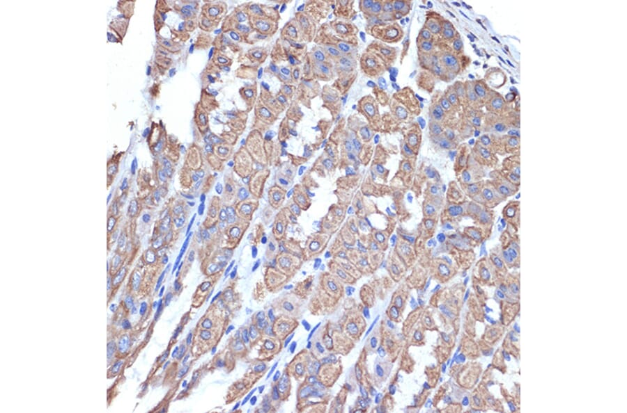 Immunohistochemistry - Anti-Cytokeratin 18 Antibody [ARC2303] (A305288) - Antibodies.com