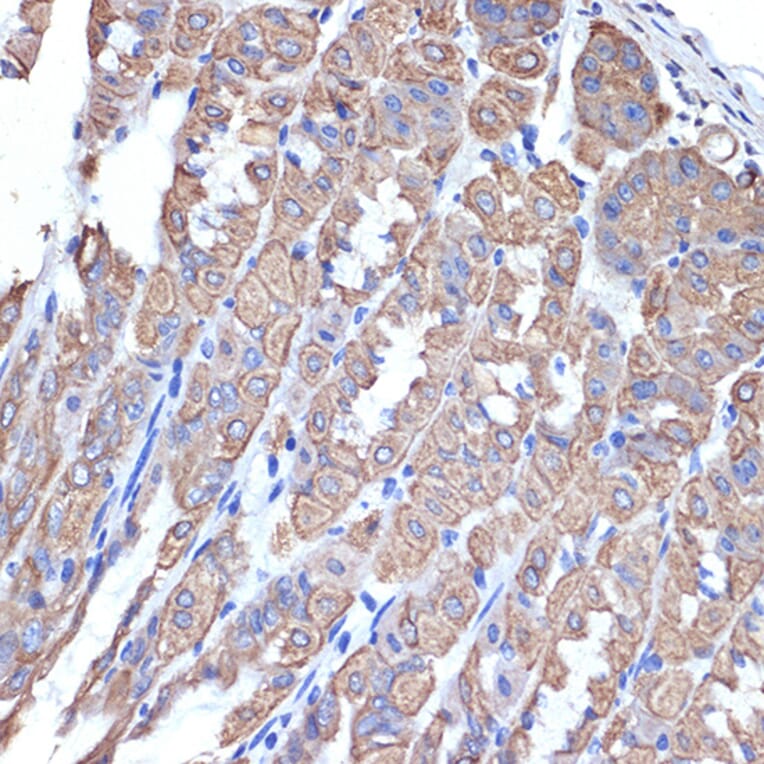 Immunohistochemistry - Anti-Cytokeratin 18 Antibody [ARC2303] (A305288) - Antibodies.com