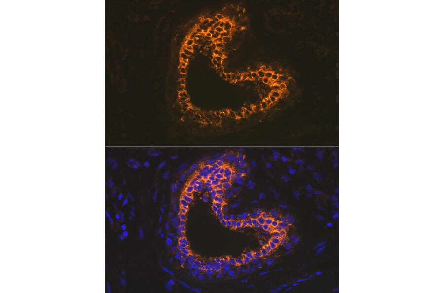 Immunofluorescence - Anti-Cytokeratin 18 Antibody [ARC2303] (A305288) - Antibodies.com