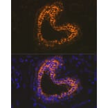 Immunofluorescence - Anti-Cytokeratin 18 Antibody [ARC2303] (A305288) - Antibodies.com