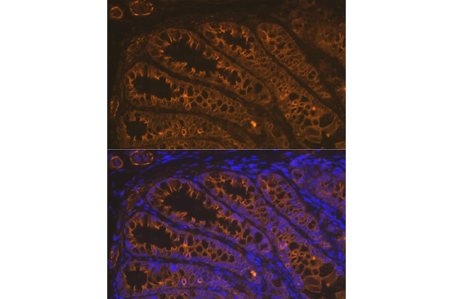 Immunofluorescence - Anti-Cytokeratin 18 Antibody [ARC2303] (A305288) - Antibodies.com