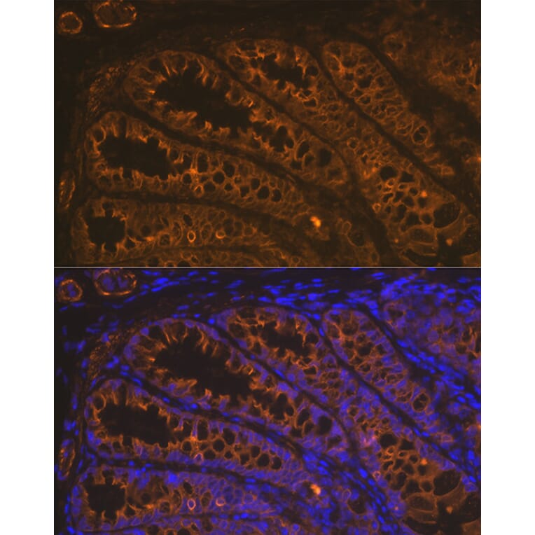 Immunofluorescence - Anti-Cytokeratin 18 Antibody [ARC2303] (A305288) - Antibodies.com