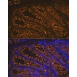 Immunofluorescence - Anti-Cytokeratin 18 Antibody [ARC2303] (A305288) - Antibodies.com