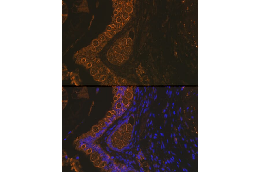 Immunofluorescence - Anti-Cytokeratin 18 Antibody [ARC2303] (A305288) - Antibodies.com