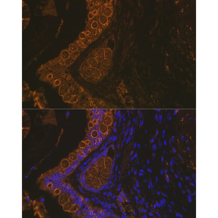 Immunofluorescence - Anti-Cytokeratin 18 Antibody [ARC2303] (A305288) - Antibodies.com