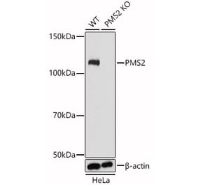 Western Blot - Anti-PMS2 Antibody (A305289) - Antibodies.com