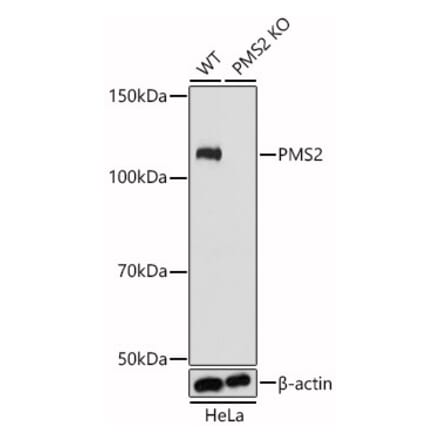 Western Blot - Anti-PMS2 Antibody (A305289) - Antibodies.com