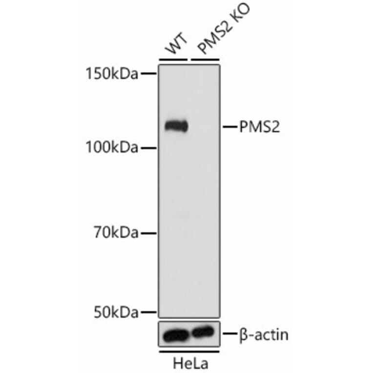 Western Blot - Anti-PMS2 Antibody (A305289) - Antibodies.com