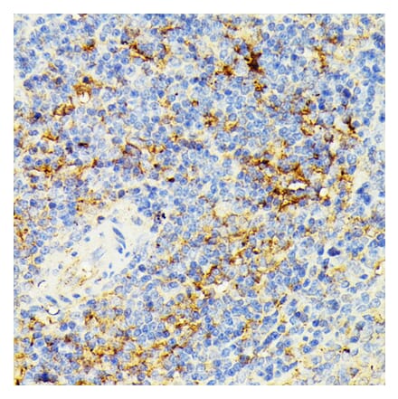 Immunohistochemistry - Anti-ECE1 Antibody (A305292) - Antibodies.com