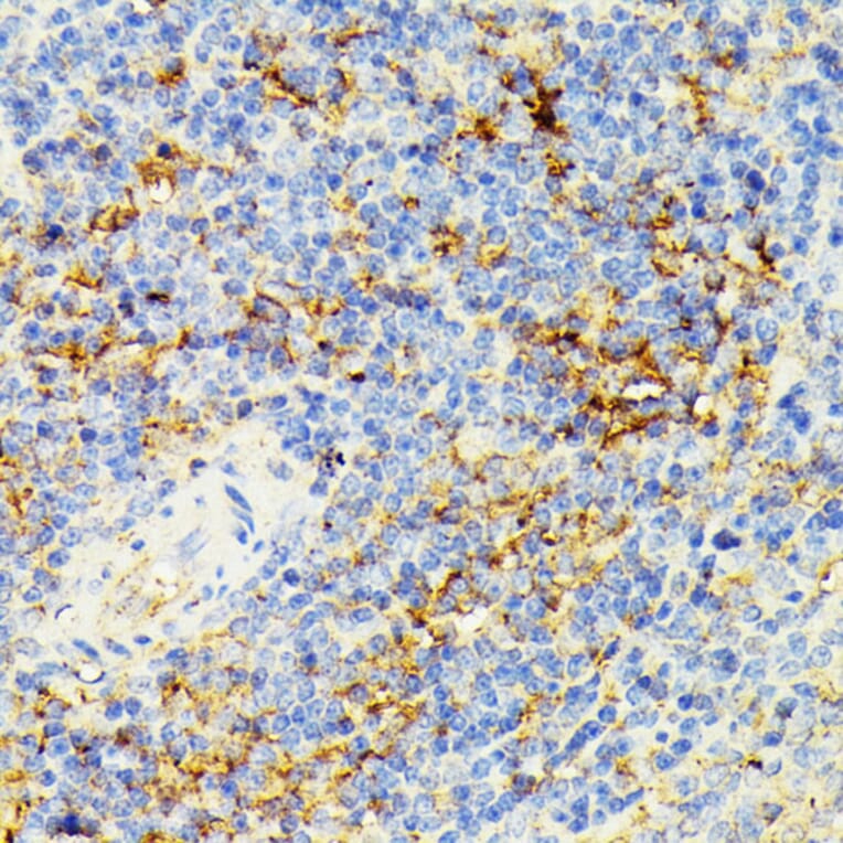 Immunohistochemistry - Anti-ECE1 Antibody (A305292) - Antibodies.com