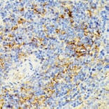 Immunohistochemistry - Anti-ECE1 Antibody (A305292) - Antibodies.com