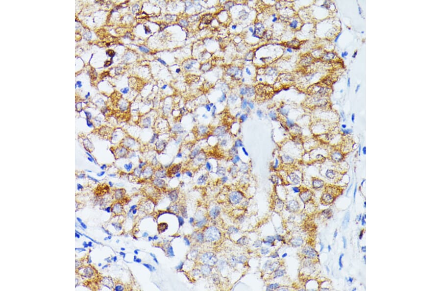 Immunohistochemistry - Anti-ECE1 Antibody (A305292) - Antibodies.com