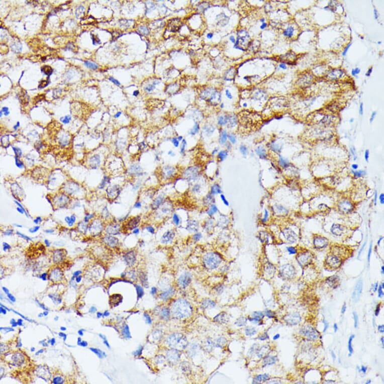 Immunohistochemistry - Anti-ECE1 Antibody (A305292) - Antibodies.com