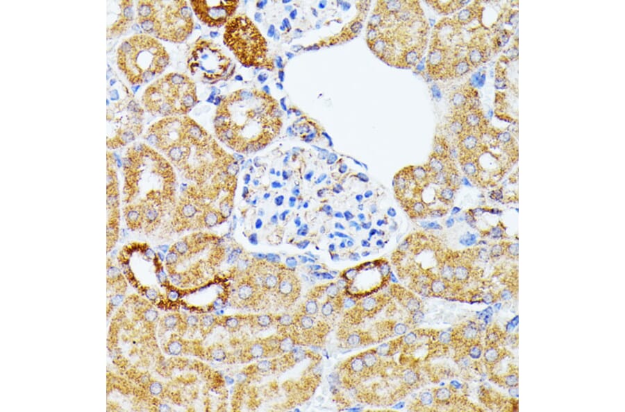 Immunohistochemistry - Anti-ECE1 Antibody (A305292) - Antibodies.com