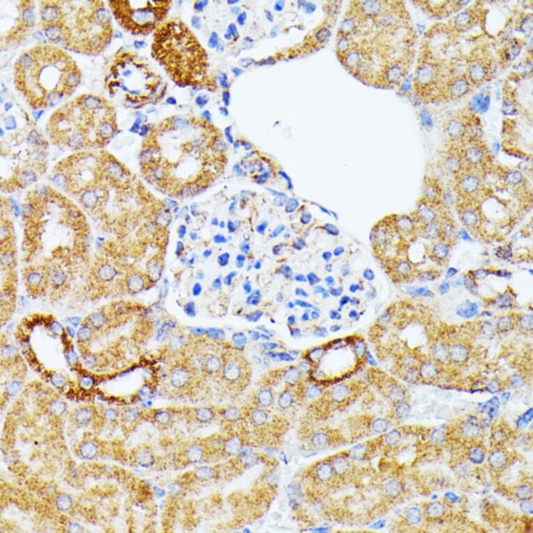 Immunohistochemistry - Anti-ECE1 Antibody (A305292) - Antibodies.com