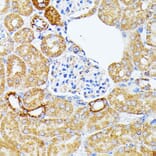 Immunohistochemistry - Anti-ECE1 Antibody (A305292) - Antibodies.com