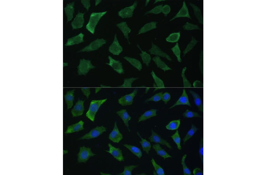 Immunofluorescence - Anti-ECE1 Antibody (A305292) - Antibodies.com