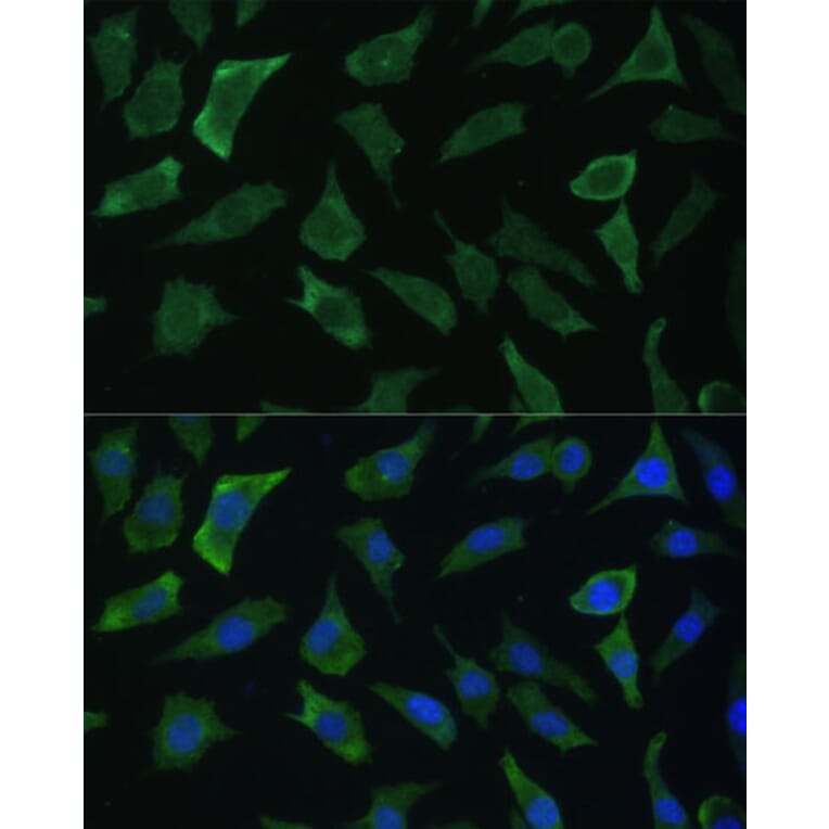 Immunofluorescence - Anti-ECE1 Antibody (A305292) - Antibodies.com