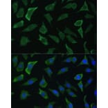 Immunofluorescence - Anti-ECE1 Antibody (A305292) - Antibodies.com