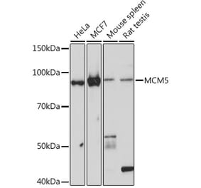 Western Blot - Anti-MCM5 Antibody [ARC1239] (A305293) - Antibodies.com