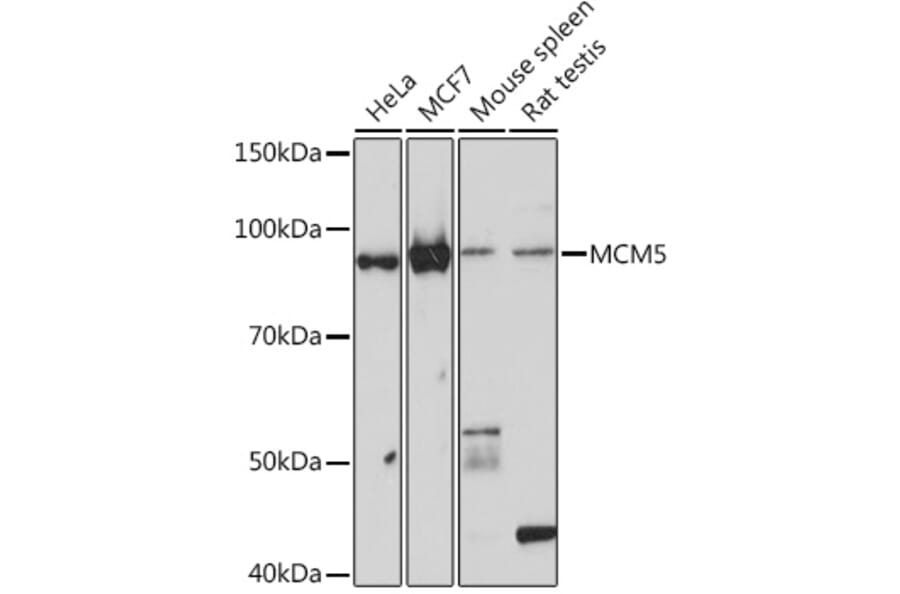 Western Blot - Anti-MCM5 Antibody [ARC1239] (A305293) - Antibodies.com