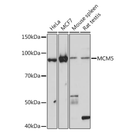 Western Blot - Anti-MCM5 Antibody [ARC1239] (A305293) - Antibodies.com