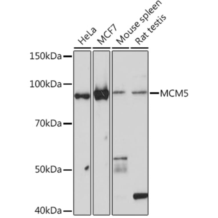 Western Blot - Anti-MCM5 Antibody [ARC1239] (A305293) - Antibodies.com