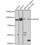 Western Blot - Anti-MCM5 Antibody [ARC1239] (A305293) - Antibodies.com