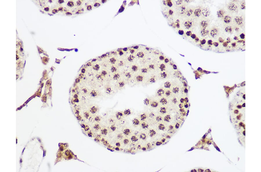 Immunohistochemistry - Anti-MCM5 Antibody [ARC1239] (A305293) - Antibodies.com