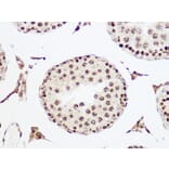 Immunohistochemistry - Anti-MCM5 Antibody [ARC1239] (A305293) - Antibodies.com