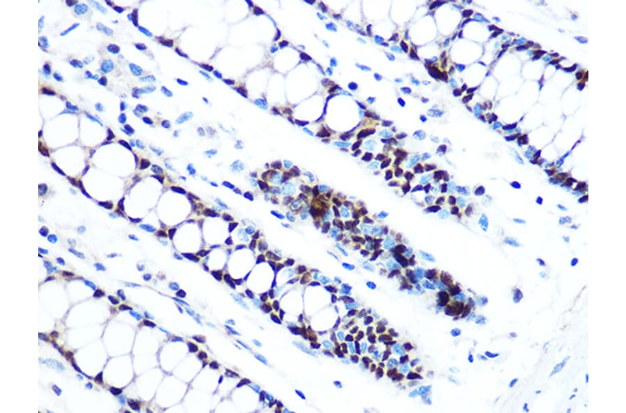 Immunohistochemistry - Anti-MCM5 Antibody [ARC1239] (A305293) - Antibodies.com