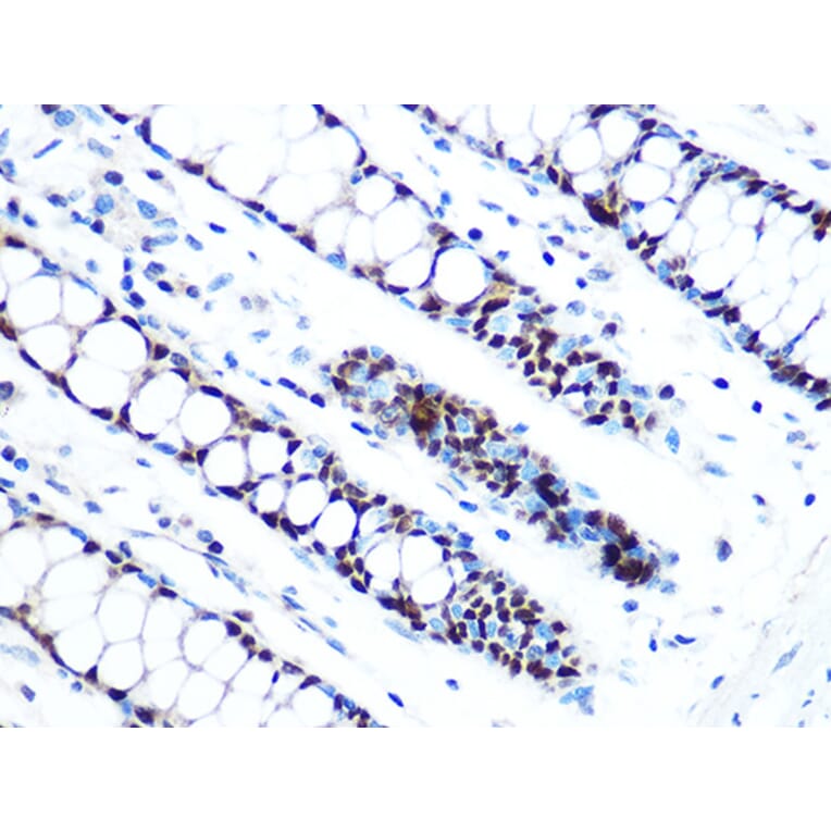 Immunohistochemistry - Anti-MCM5 Antibody [ARC1239] (A305293) - Antibodies.com
